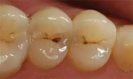 1468372814162660.jpg 1.jpg