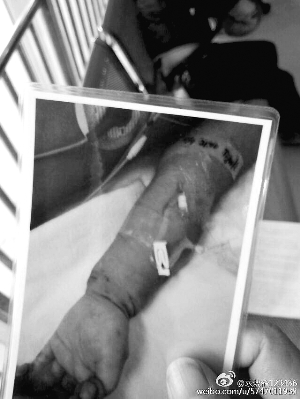 1470909921387673.jpg W020160811264769405827.jpg