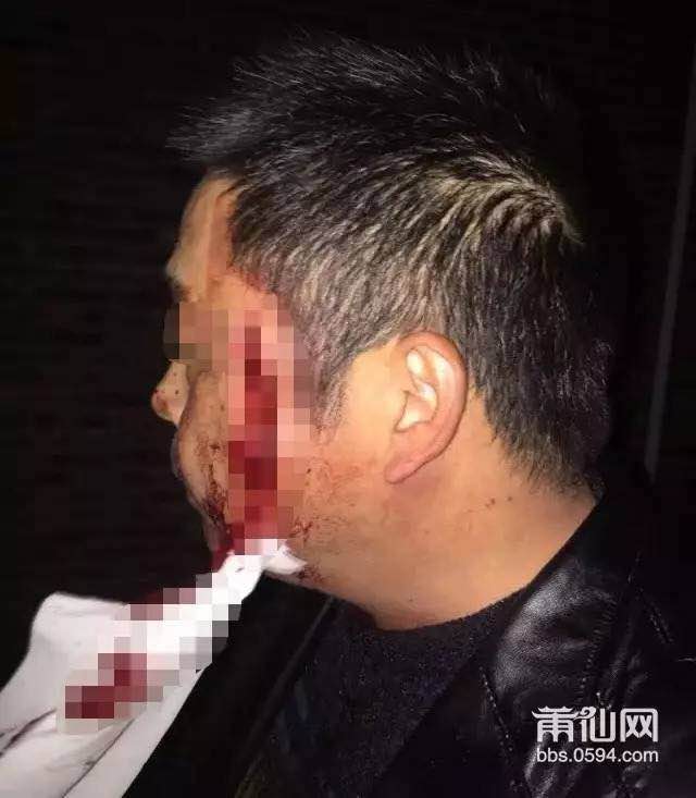 1487293767136165.jpg 4.jpg