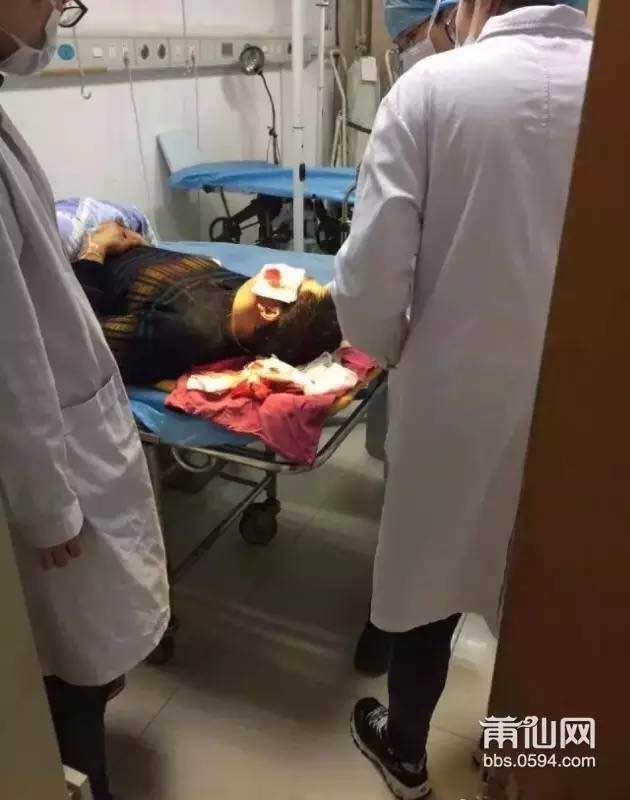 1487293782778444.jpg 5.jpg