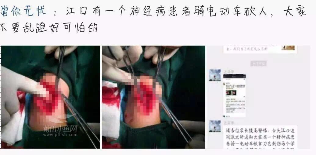 1489537398102867.jpg 4.jpg